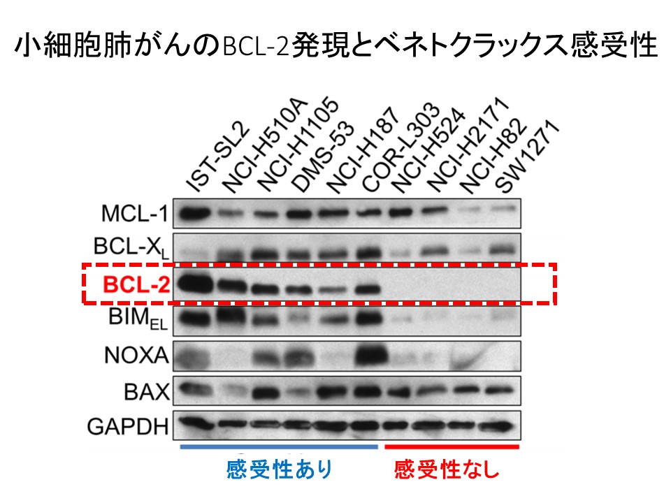 小細胞肺がんセルラインBCL-2発現とベネトクラックス感受性