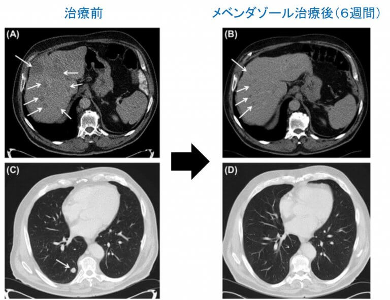フェンチゾール胚珠リーフレット